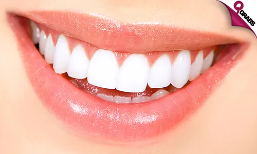 Teeth Whitening, Snap On Smile, Hollywood Smile & More!